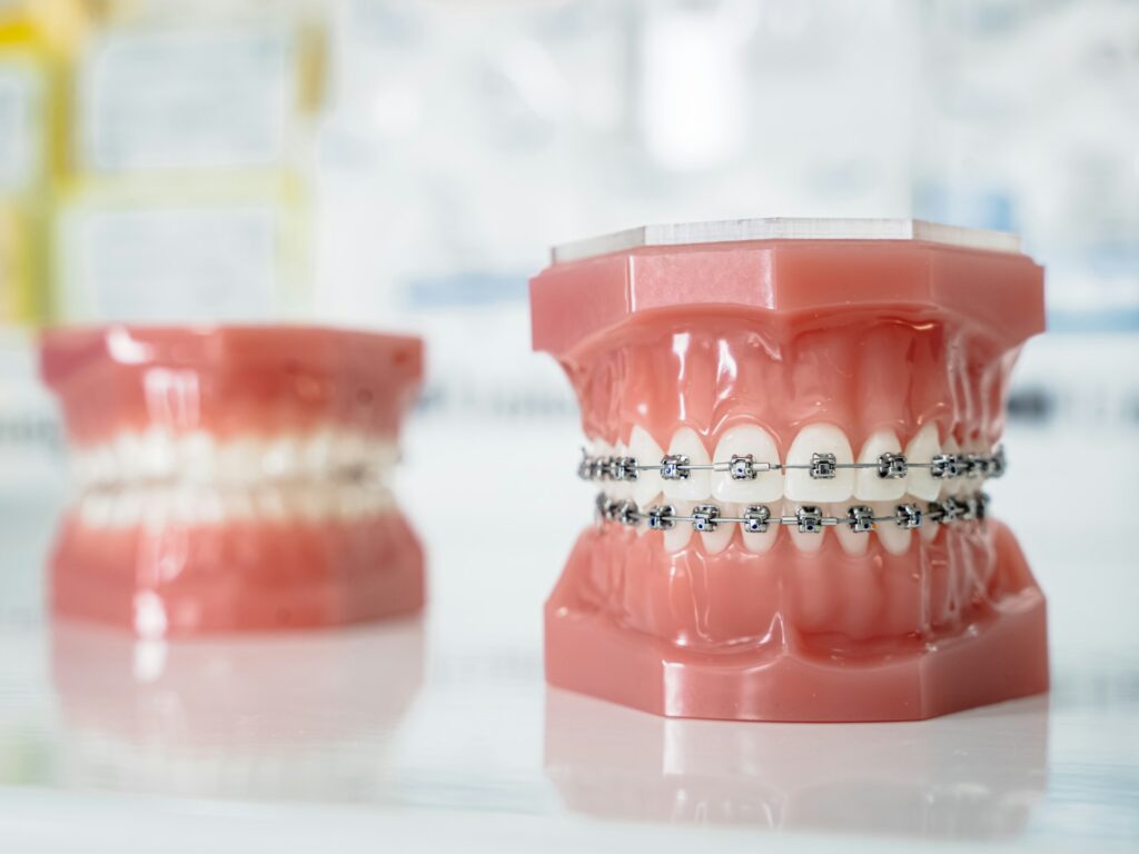 Orthodontics seminar